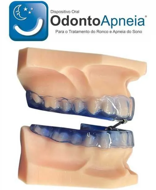 Aparelho Intraoral para Apneia do Sono do Sistema Odontoapneia, com as duas placas encaixadas no modelo